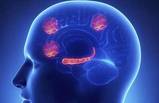 经颅磁刺激疗法——轻微脑梗塞是什么症状 
